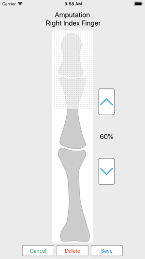 Impairment Calculator 4th ed.(圖3)-速報App