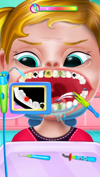 Crazy Dentist Clean Teeth Game screenshot-6