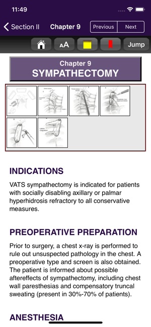 Atlas of Min. Invasive Surgery(圖4)-速報App