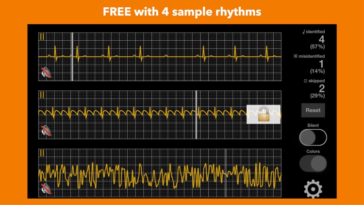 arrhythmia screenshot-3