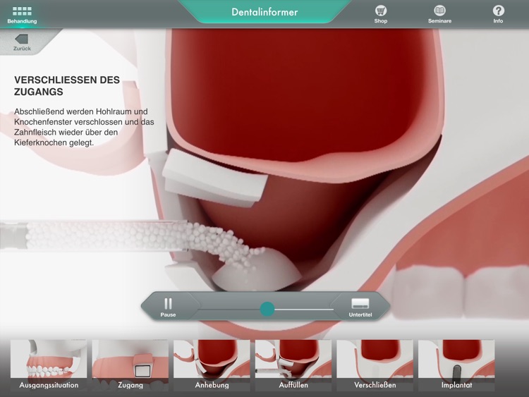 Dentalinformer screenshot-4