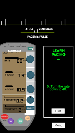 Learn Pacing