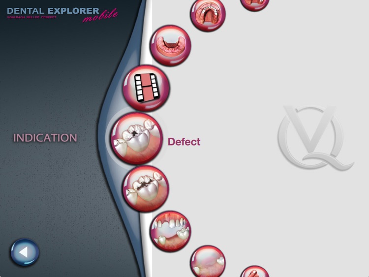 DENTAL EXPLORER mobile