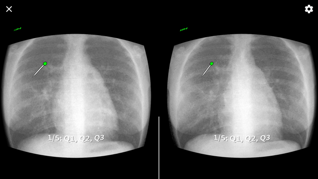 MacAnatomy VRBR(圖3)-速報App