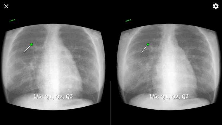 MacAnatomy VRBR