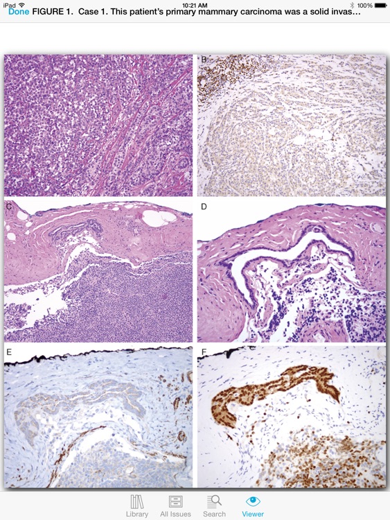 The American Journal of Surgical Pathology screenshot-4