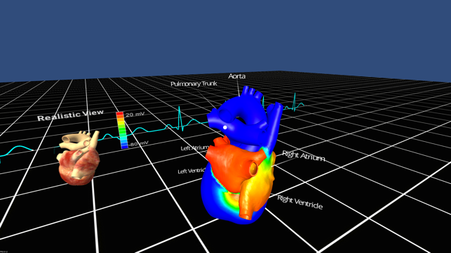 Living Heart for Cardboard VR(圖4)-速報App