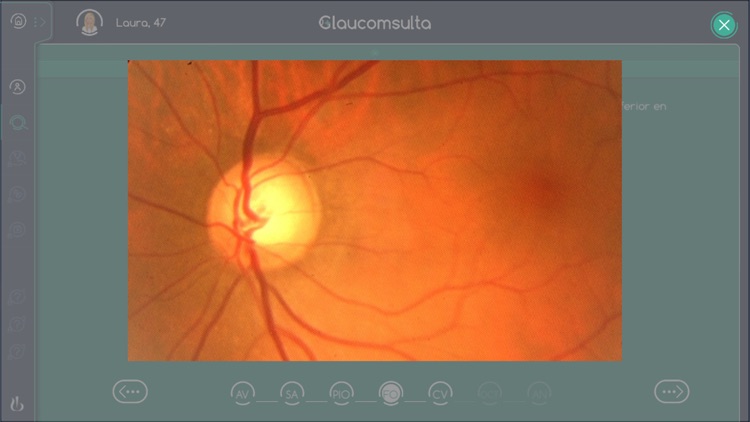 Glaucomsulta screenshot-3