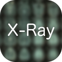 X-Ray Differential Diagnosis PC 용