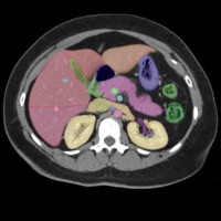 Anatomy on Radiology CT  PC 용