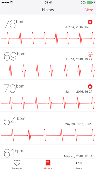 Cardiograph Screenshot 3