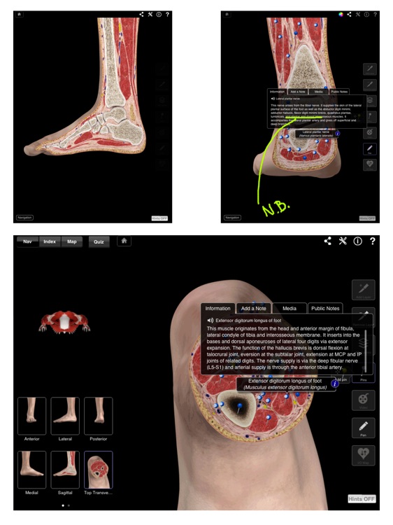 Ankle & Foot Pro III for iPad