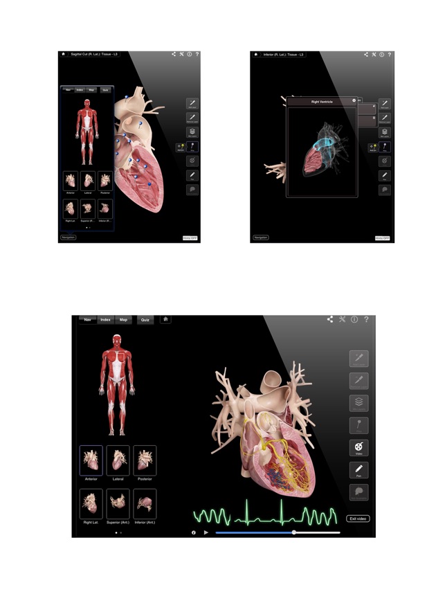 Heart Pro III(圖4)-速報App