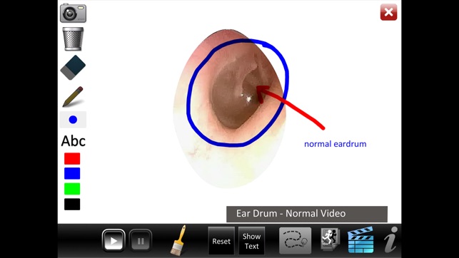 Ear ID(圖5)-速報App