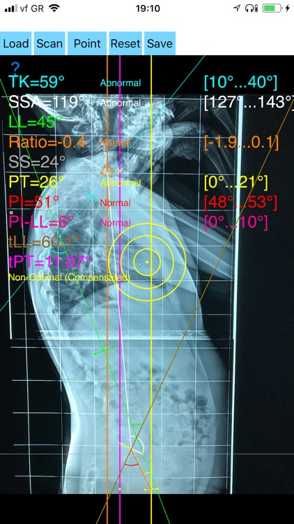 SagittalBalanceApp