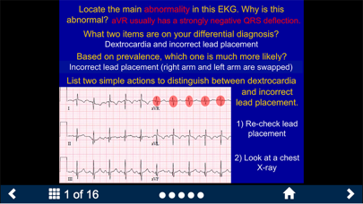 EKG - SecondLook screenshot 4