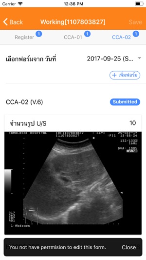 CASCAP Mobile U/S(圖5)-速報App