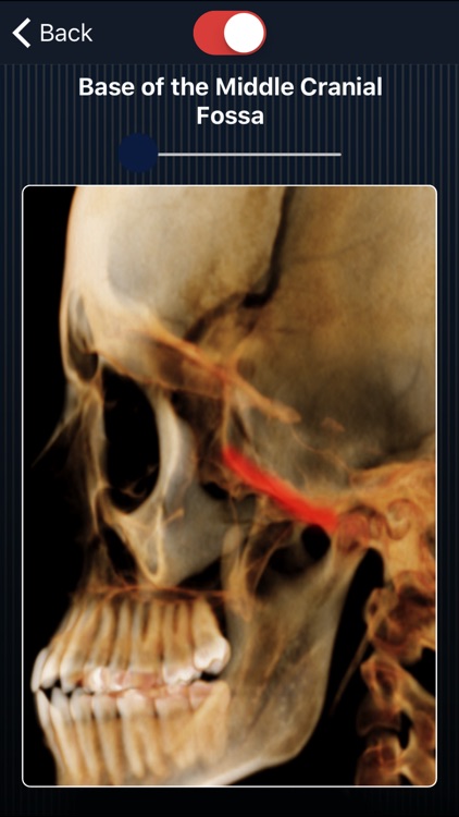 Dental Panoramic Radiology screenshot-3