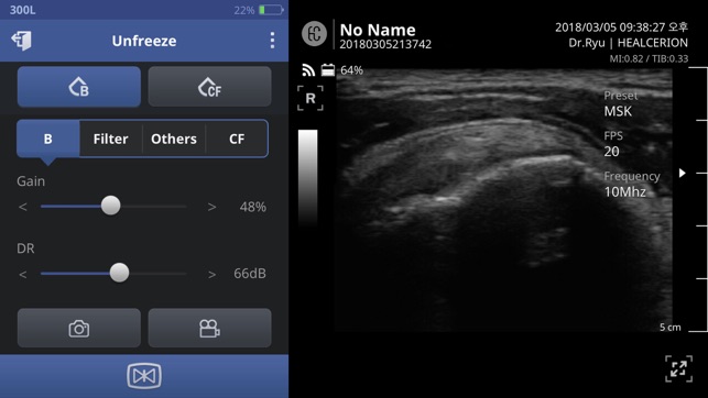 SONON Ultrasound App(圖2)-速報App