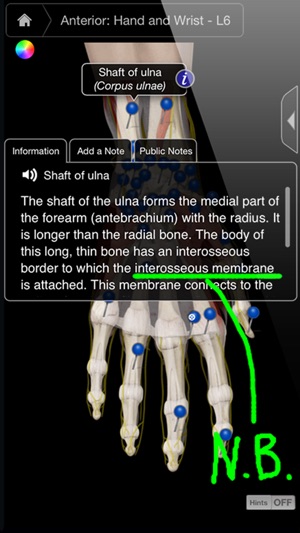 Hand & Wrist Pro III(圖2)-速報App