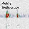 Mobile Stethoscope