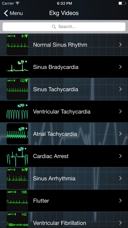 EKG Clinical screenshot-3