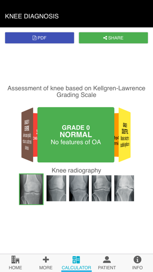 Doctor Support Osteoarthritis(圖3)-速報App