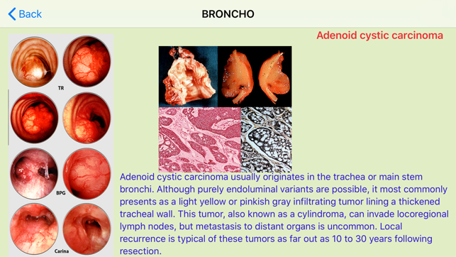 BRONCHO-(圖5)-速報App