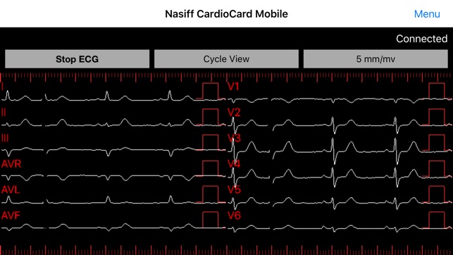 CardioCard Mobile(圖2)-速報App