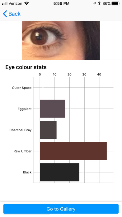 Eye Color Analyzer - UNiKA screenshot 3