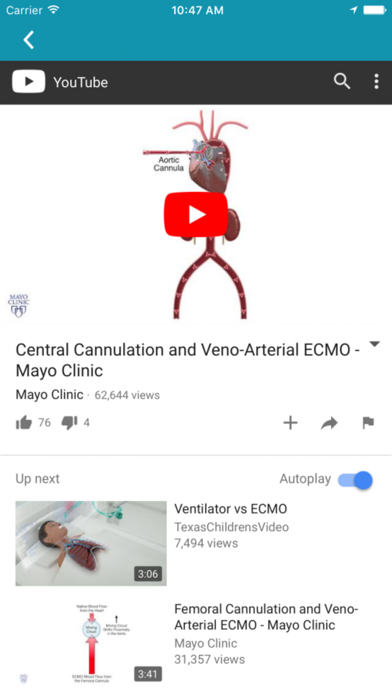 How to cancel & delete ECMO. from iphone & ipad 3