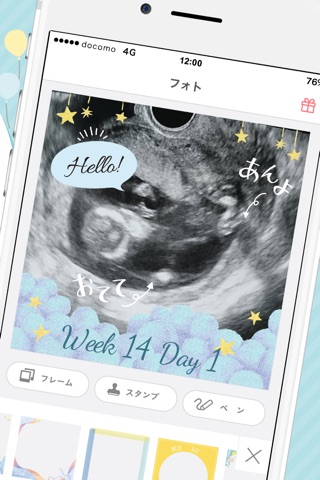 【mier】エコー写真をアレンジして妊娠期間をもっと楽しく！ screenshot 2