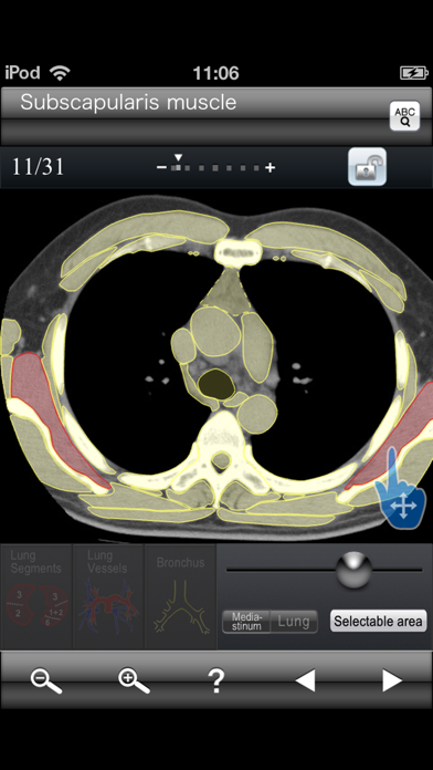 Chest CT Sectional Walker Screenshot 5