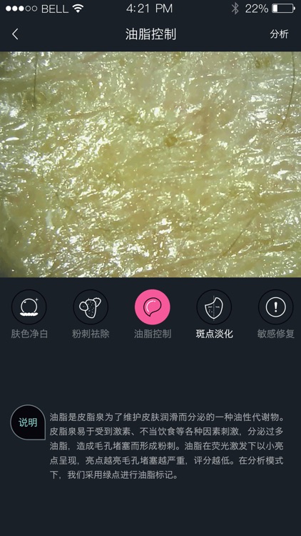 护肤AI检测 screenshot-3