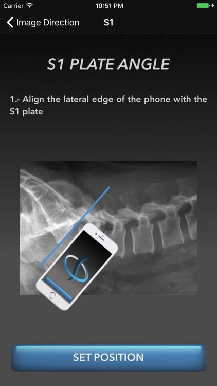 Sagittal Balance Advance