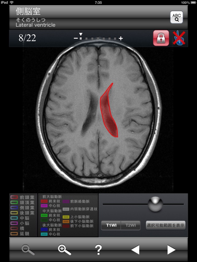 断面図ウォーカー脳MRI im App Store