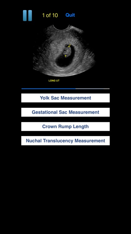 Sono Quiz OB-GYN