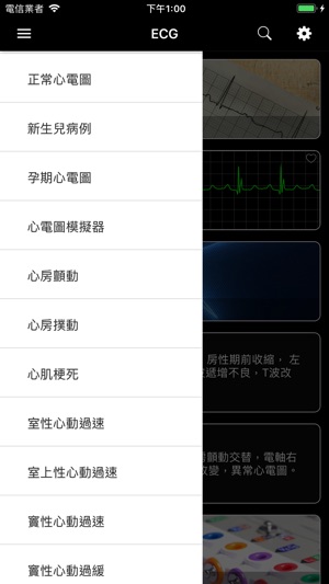 ECG Pro - 海量心電圖案例和診斷詳解(圖8)-速報App