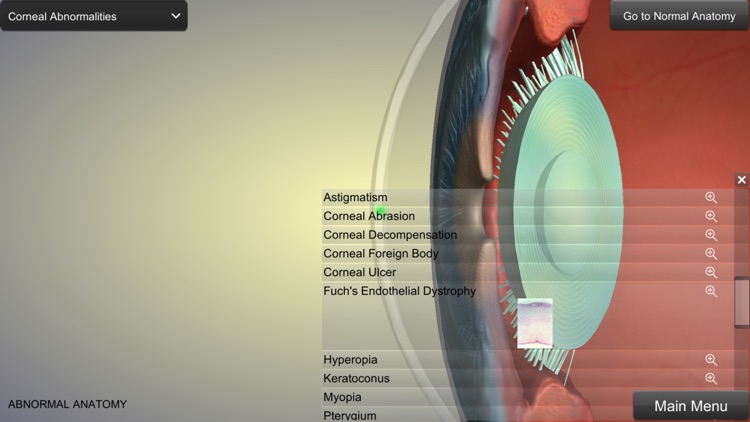 Eye Anatomy