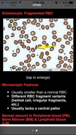 Hematology Outlines Atlas(圖5)-速報App