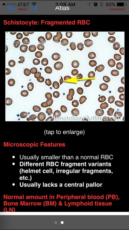 Hematology Outlines Atlas screenshot-4