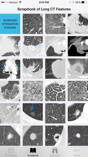 Lung CT Field Guide(圖3)-速報App