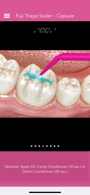 GC Restorative Dentistry(圖4)-速報App