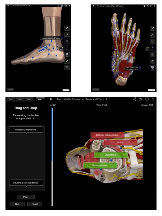 Ankle & Foot Pro III for iPad