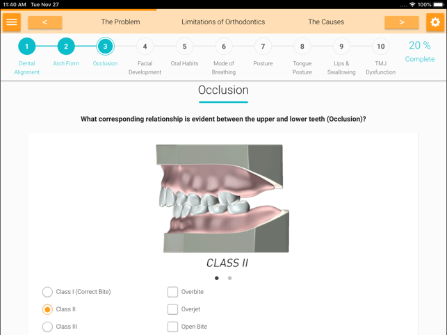 Myobrace Consultation(圖5)-速報App