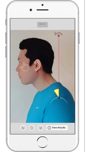 Forward Head Posture (FHP)(圖2)-速報App