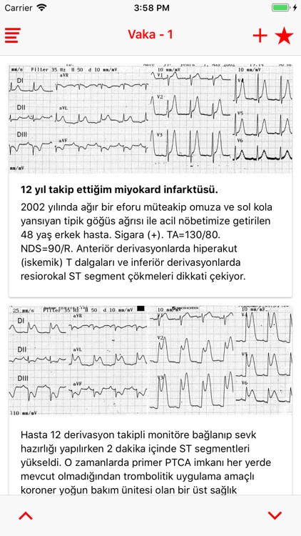 Acil EKG Lite screenshot-4