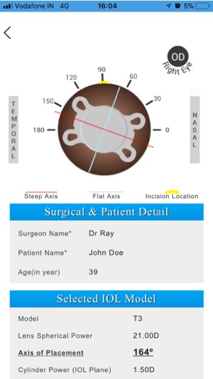 Axis Toric Calculator(圖7)-速報App