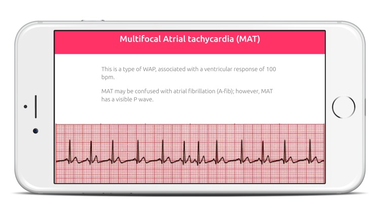 ECG FlashCards Pro