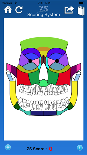 ZS Maxillofacial Trauma Score(圖2)-速報App